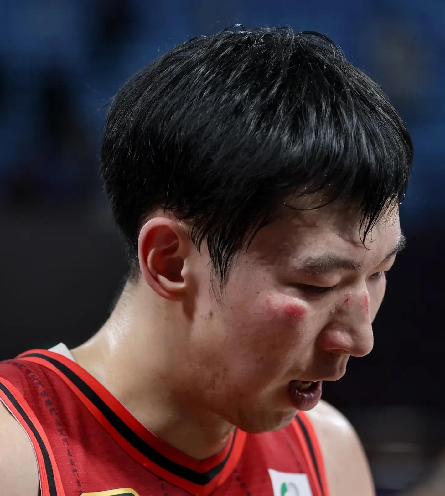 主力球员受伤，替补队员展现实力